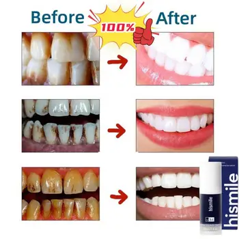 V34 הלבנת שיניים נגינה מיידית שיניים מלבין שיניים Brightener סגול משחת שיניים הלבנת שיניים תיקון להפחית מצהיבים